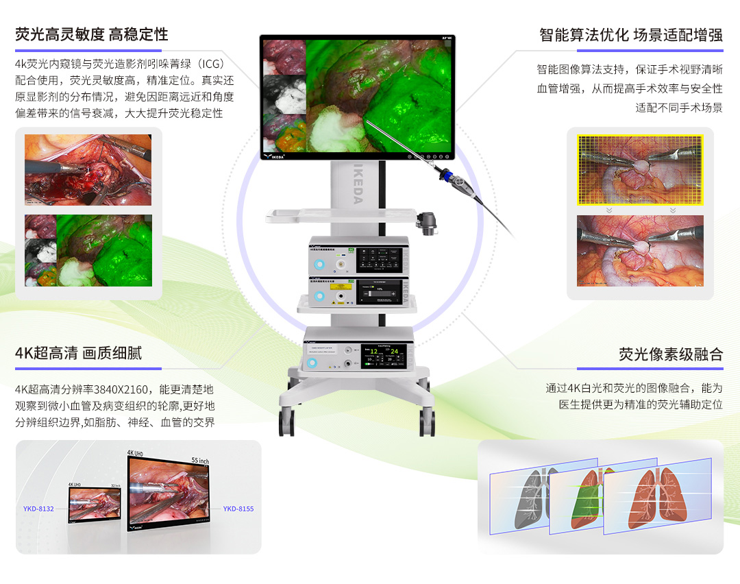 4K熒光內(nèi)窺鏡攝像系統(tǒng) 4K熒光內(nèi)窺鏡攝像系統(tǒng)